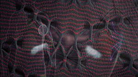 Thermosyphon® 3D Bionic Sphere® System z technologią Thermosyphon® na klatce piersiowej